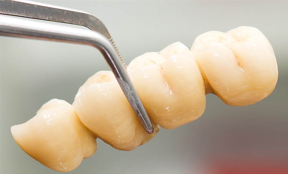 پروتز دندانسازی سینا