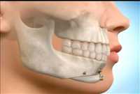 دکتر مسعود فلاحتی مطلق | جراح دهان، فک و صورت