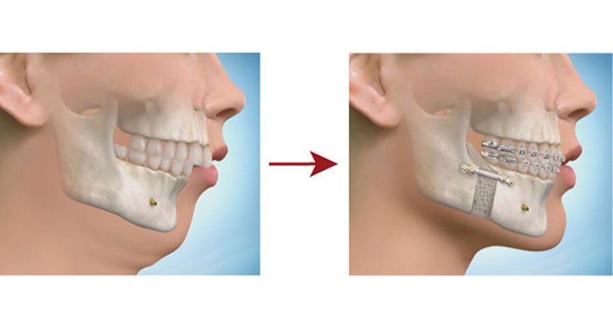 دکتر مسعود فلاحتی مطلق | جراح دهان، فک و صورت
